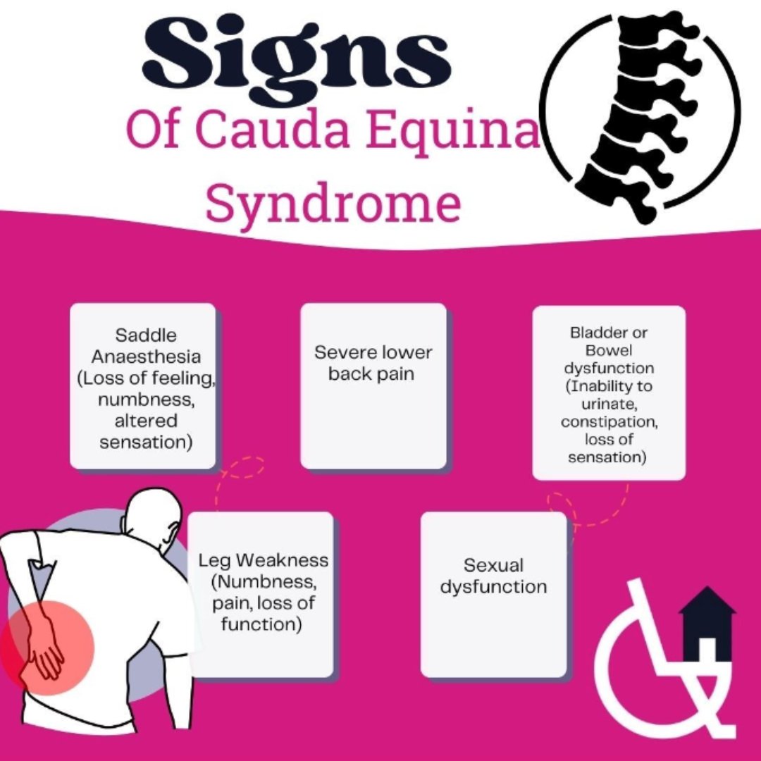 QuadRebuild18's tweet image. Cauda Equina Syndrome (CES) is a serious emergency caused by nerve compression at the spinal cord base.

⚠️ Symptoms:
•Severe lower back pain
•Numbness in the groin (saddle anesthesia)
•Bladder/bowel issues
•Leg weakness

⏰ Early surgery can prevent permanent damage!