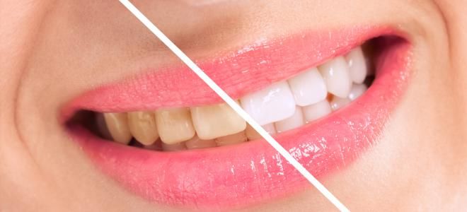 AzelCosmetic's tweet photo. Vous souhaitez un sourire éclatant! 😊 Découvrez notre gamme innovante de dentifrices liquides respectueux de la #nature # qui vous permet d'avoir une très bonne hygiène dentaire sans brossage ! #Innovation #MadeInFrance #dentifrice #baindebouche #Lille #hautdefrance https://t.co/MLQFmugytv