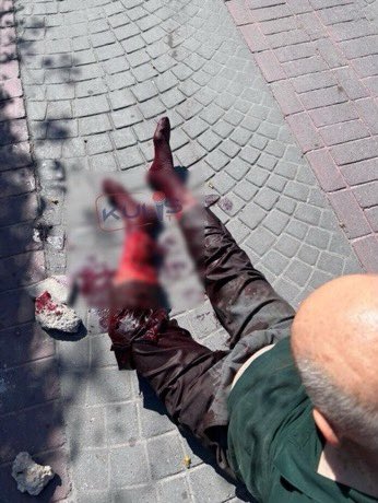 2025 Türkiye'si 🇹🇷

Adam köpeği öldürseydi veya sakatlasaydı tüm sülalesi ile birlikte linç malzemesi haline getirilip,en yüksek ceza ile hapiste yatacaktı.

Köpek adamı sakatladığı için sahibine mahkeme huzurunda insanların hayatı ile oynandığı için "Teşekkür edip" evine