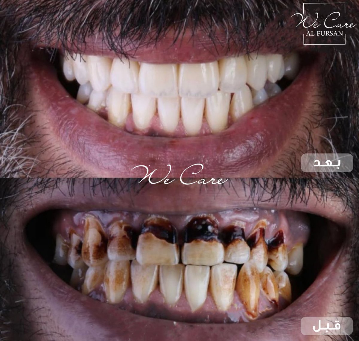 رجع ضحكتك وثقتك بنفسك
مهما كانت حالة اسنانك .. نعالجها لك 👌
ابتسم بثقة

#مركز_الفرسان_الطبي 
الرياض - حي الملك سلمان 
📞 0535019888