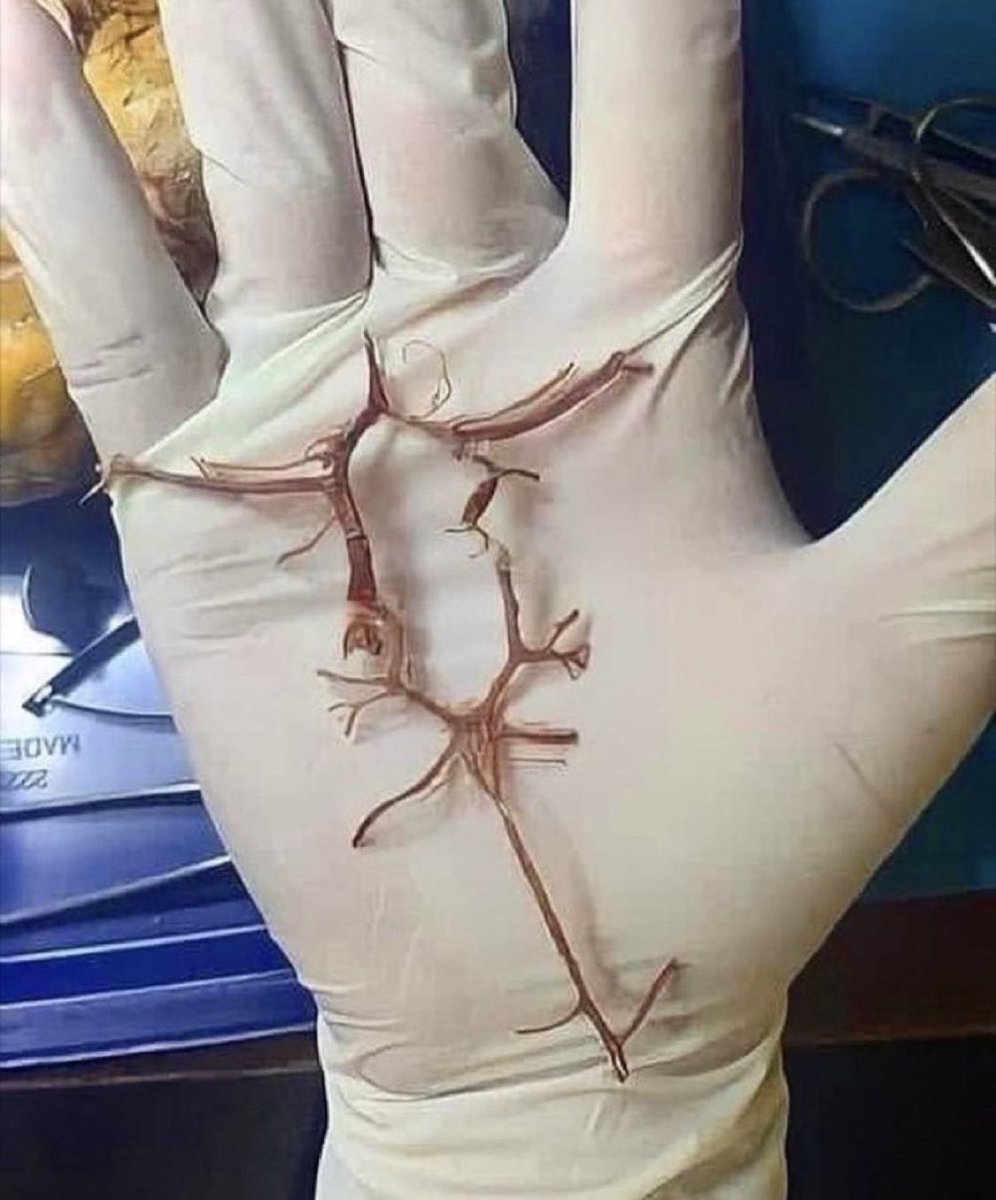 Dr Honey choudhary 🩺 tweet media