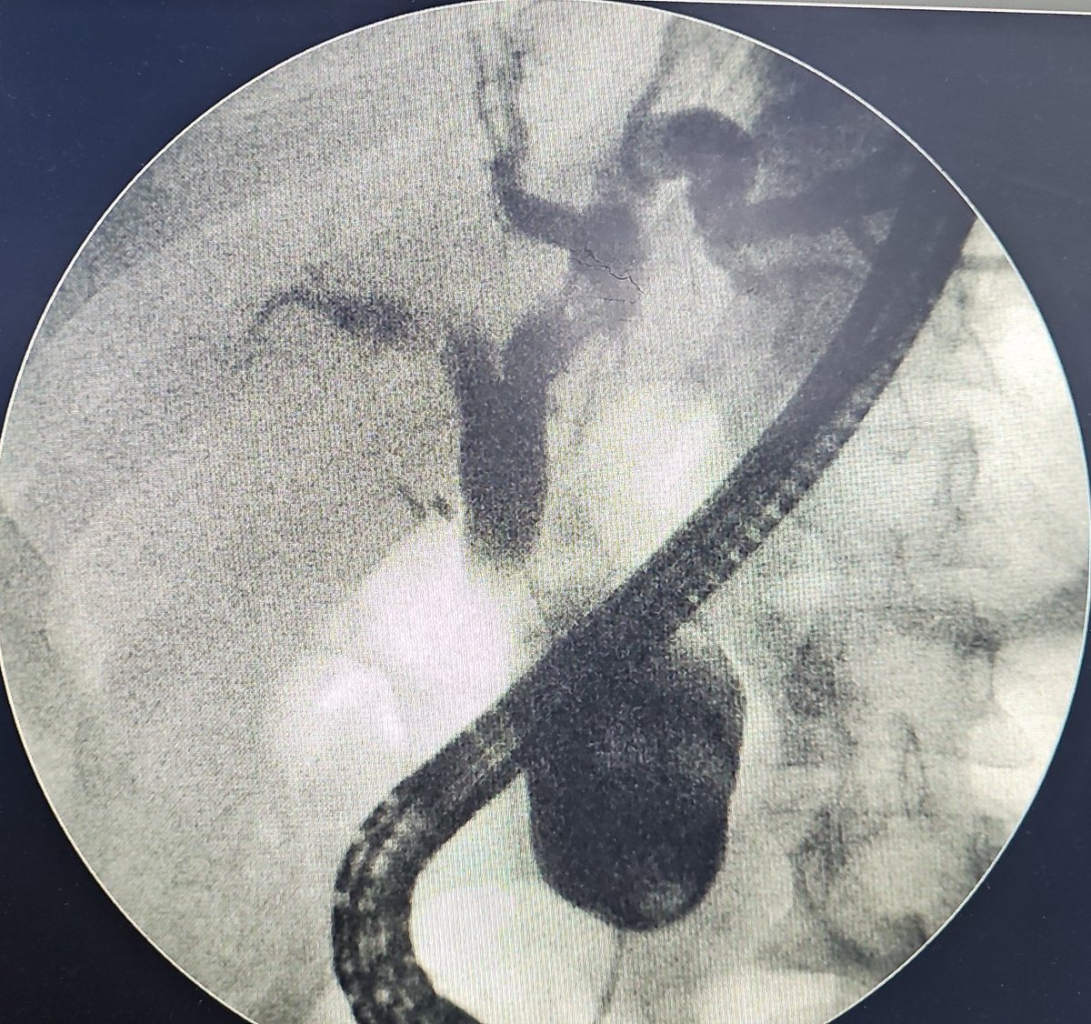 Turki AlAmri |تُرْكي عبدالله الْعَمريَّ MD tweet media