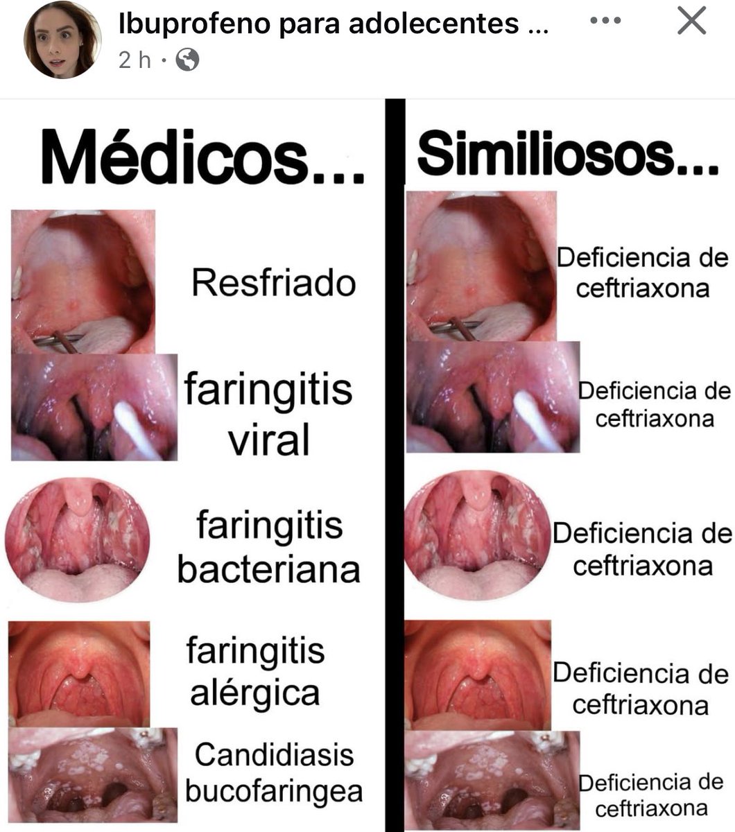 Otorrhinorincus of Wellness (@otorrhinorincus) on Twitter photo 