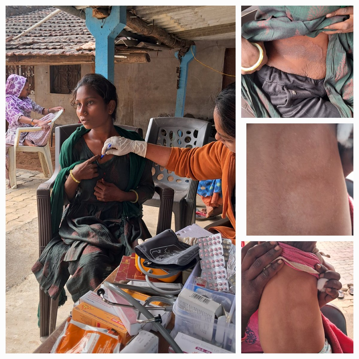 AAM_Valpor's tweet image. *🏥#AAM #VALPOR 🏥આજ રોજ aam *valpor ના રૂપઘાટ ગામમાં રક્તપિત રોગ વિશે ગ્રામજનોને માહિતી પુસ્તિકા દ્વારા સમજાવામાં આવ્યું,*
*ઘરઆંગણે કોઈ પણ વ્યક્તિ ને શરીર પર ડાઘ ચાંઠા ,કે અન્ય ચામડીની તકલીફ હોય તો આશા કે આરોગ્ય કર્મચારીઓ ને જાણ કરવા જણાવવામાં આવ્યું હતું..*