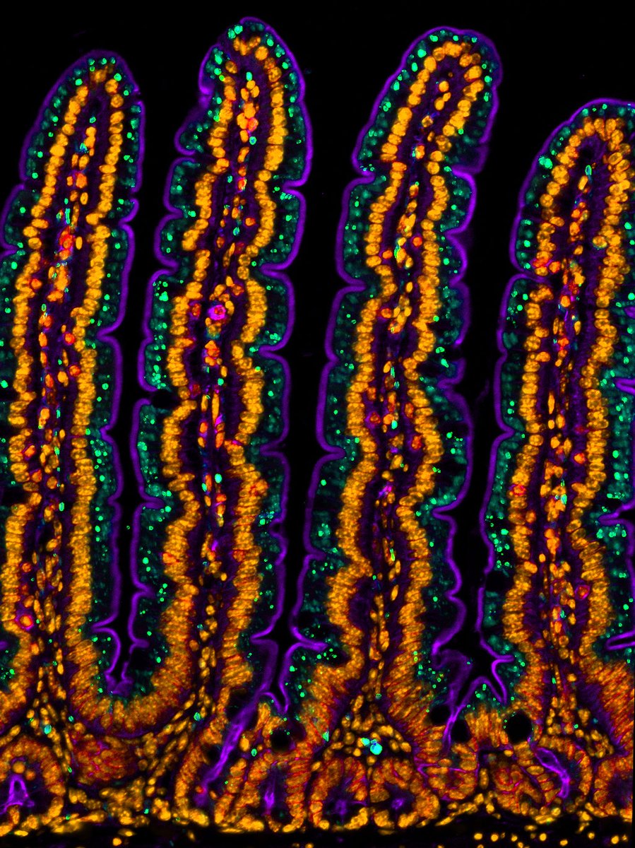 Last #FluorescenceFriday of 2024!

#microscopy #pathart #histoart #intestine #FluorescentFriday