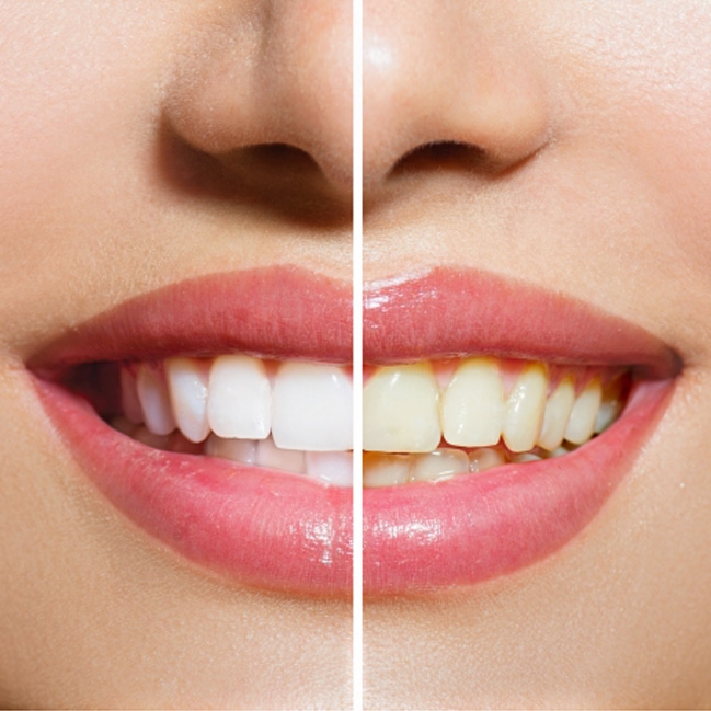 AzelCosmetic's tweet photo. Vous souhaitez un sourire éclatant! 😊 Découvrez notre gamme innovante de dentifrices liquides respectueux de la #nature # qui vous permet d'avoir une très bonne hygiène dentaire sans brossage ! #Innovation #MadeInFrance #dentifrice #baindebouche #Lille #hautdefrance https://t.co/QoPdQsrAAQ