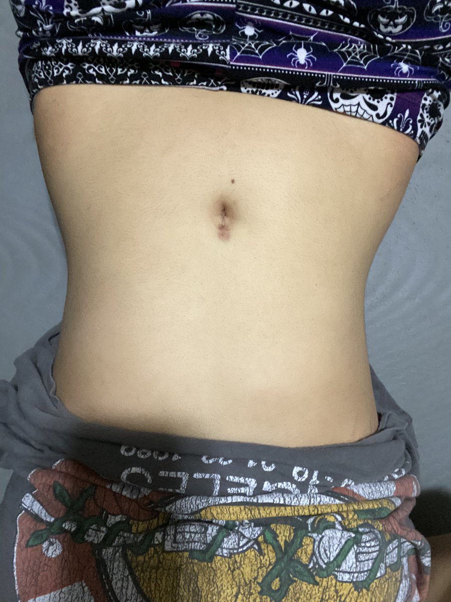 bugskeleton's tweet image. Body check the body is starting to look tea guys💪😝