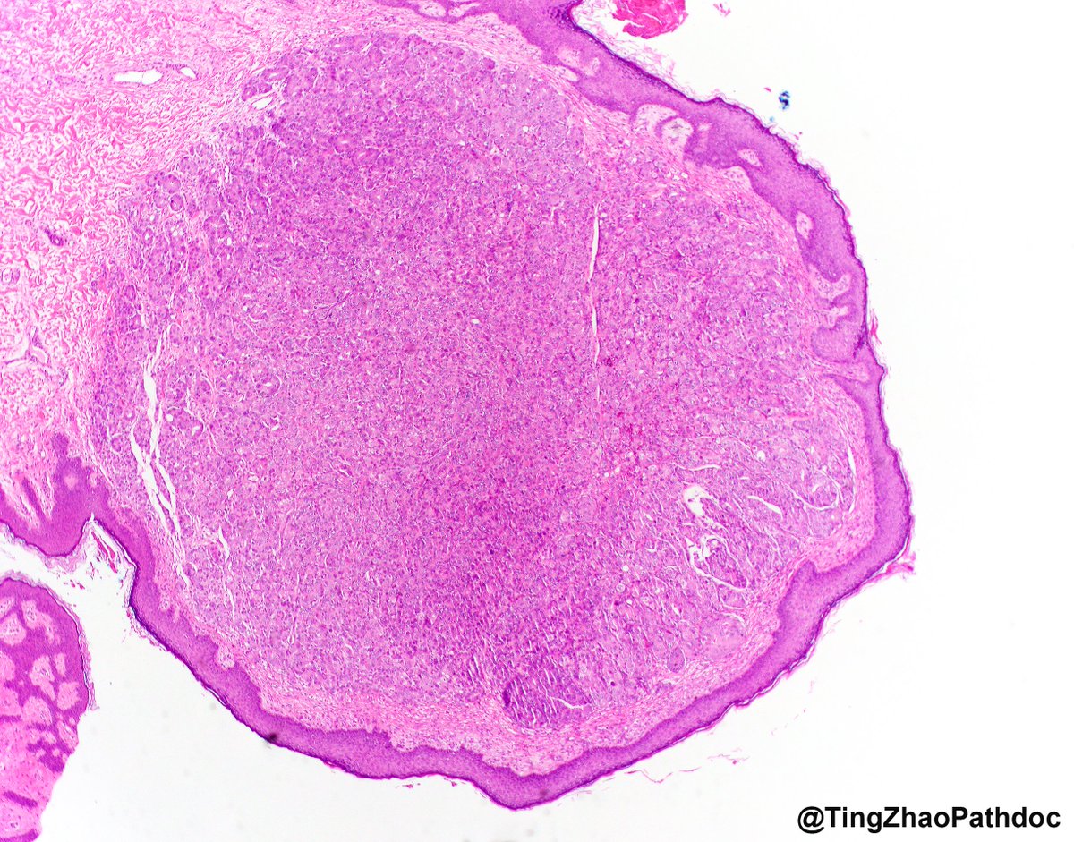 Ting Zhao, MD tweet media