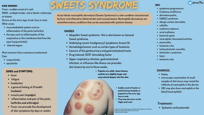 Scott C. Howard (@schowardjd) on Twitter photo <a href="/drsthanus/">Dr sthanu subramanian</a> Suspected Sweet's syndrome (acute febrile neutrophilic dermatosis) in a patient with Crohn's disease.
DDx: pyoderma gangrenosum
<Image source: <a href="/rav7ks/">Ravi Singh</a> via <a href="/grepmeded/">GrepMed</a> , tinyurl.com/26hx8c5m> <a href="/drsthanus/">Dr sthanu subramanian</a> Suspected Sweet's syndrome (acute febrile neutrophilic dermatosis) in a patient with Crohn's disease.
DDx: pyoderma gangrenosum
<Image source: <a href="/rav7ks/">Ravi Singh</a> via <a href="/grepmeded/">GrepMed</a> , tinyurl.com/26hx8c5m>