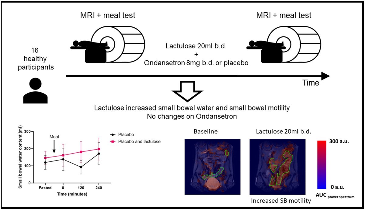 NGMJournal's tweet image. In healthy volunteers, #Lactulose ⬆️#SmallBowel #WaterContent &amp;amp; stimulates #SmallBowelMotility; but had no impact on #colonic water content 👏
▶️#Laxative effect is not #osmotic but due to stimulation of #Motility🔥
👉onlinelibrary.wiley.com/doi/10.1111/nm…
@ANMSociety @esnm_eu
#GITwitter