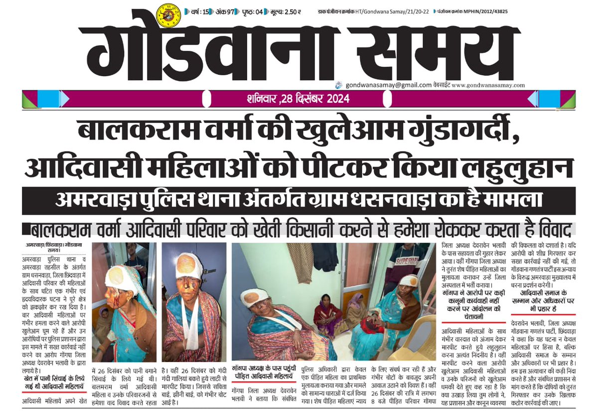 बालक राम वर्मा ने की खुलेआम गुंडागर्दी आदिवासी महिलाओं को पीटकर किया लहूलुहान, छिंदवाड़ा जिला के अमरवाड़ा के ग्राम धसनवाड़ा का है मामला
<a href="/roat_mla/">Rajkumar Roat</a>,<a href="/CMMadhyaPradesh/">Chief Minister, MP</a> ,<a href="/SamayGondwana/">Gondwana Samay</a> ,<a href="/dmchhindwara/">Collector Chhindwara</a>,<a href="/prochhindwara/">PRO JS Chhindwara</a>
