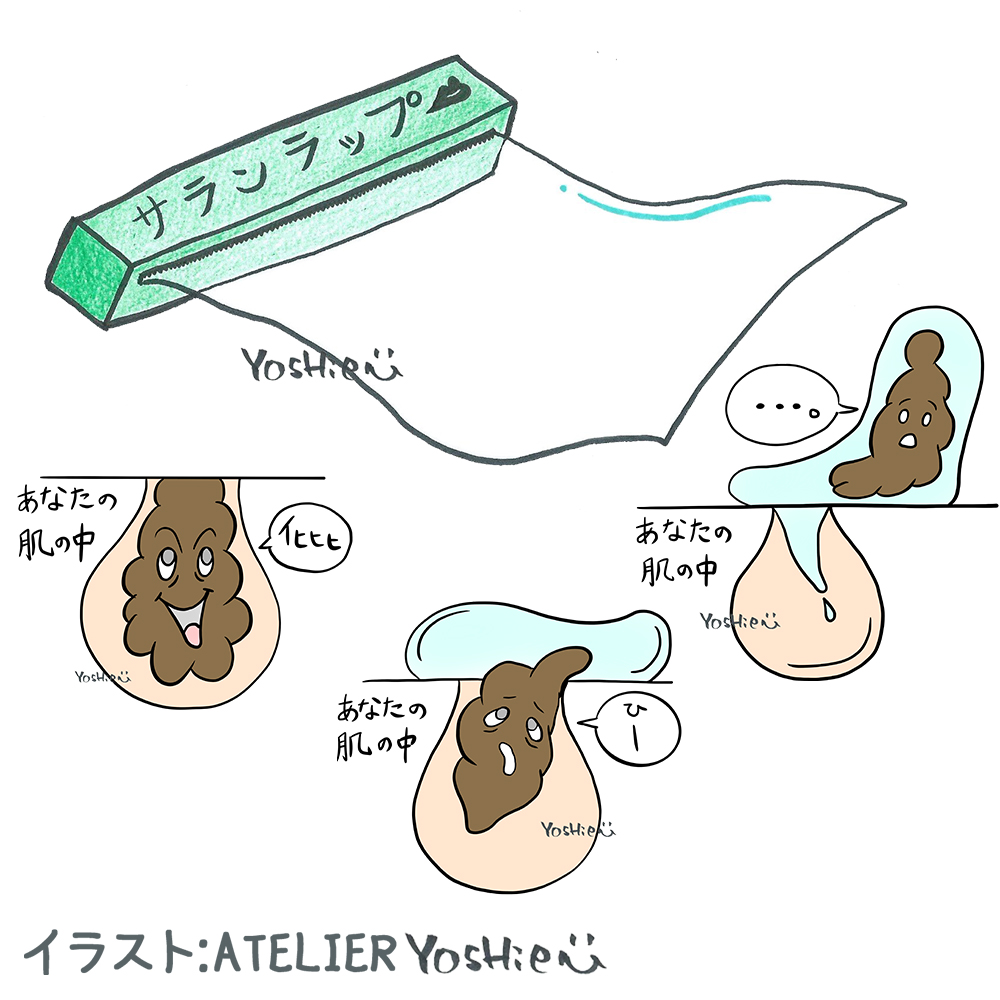 GLAMORIUM's tweet photo. モイストクリームはニキビ・吹き出物の強い味方😆ダブルクレンジングゲルで肌を柔軟にした後に、モイスチャーローション→モイストクリームを気になる箇所に多めにつけて、ちぎったサランラップをON😌パック状態にしてあげてね。集中ケアにおススメです。サランラップを剥がしたらいつものケア🤗 https://t.co/ltZJB15jMo