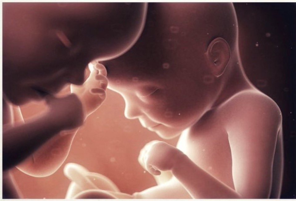 FDHumana's tweet photo. Su vida, un grito silencioso por la paz y la justicia. Hoy recordamos a los Santos Inocentes, a todos los niños que no tuvieron la oportunidad de vivir. Honremos su memoria y trabajemos juntos por un mundo más humano. 
La vida es un regalo precioso. 
#SantosInocentes #Vida #Paz https://t.co/NzJQRNa1Mt