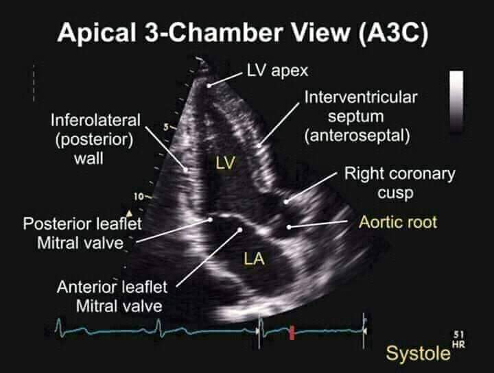 Echocardiography views