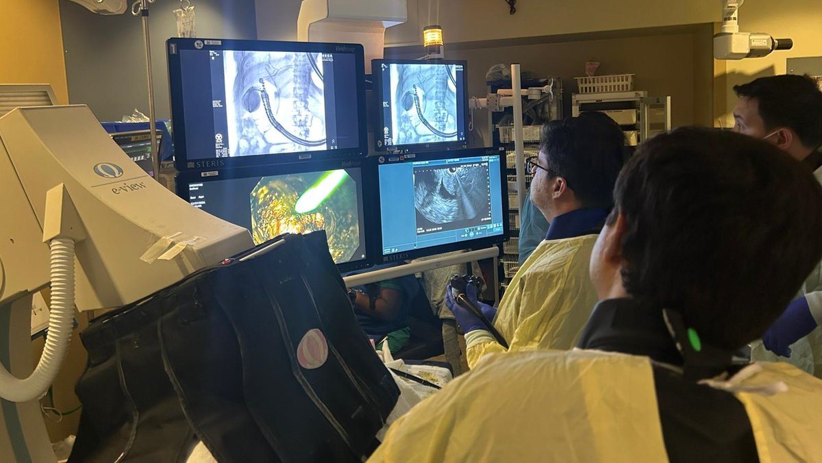 SChandanMD's tweet photo. #DayInTheLife of an #AdvancedEndoscopy fellow at #CIE @AdventHealth β
π Acute cholecystitis
β Non surgical candidate
π― EUS-guided cholecystoduodenostomy (gallbladder drainage) performed successfully with our wonderful PD "Dr. K" @KKadkhodayan sir π
#CIEDays #GITwitter https://t.co/HfKjKAzs4r