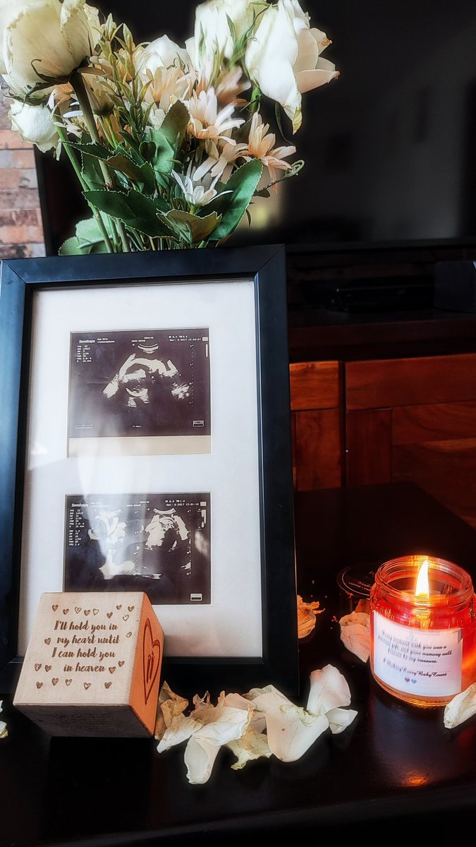kecho1's tweet photo. Remembering Keitangaza: Happy 7th heavenly birthday 💜

#MakingEveryBabyCount🩷💙 https://t.co/oXNXSmU3Lb