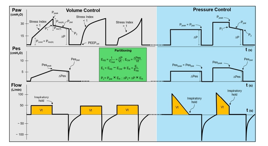 SOMELaguna's tweet photo. Evaluación del Sistema Respiratorio Durante la Ventilación Mecánica Invasiva 🫁🏥

🔰📚Clin. Med. 2024

https://t.co/jIqvgvX2Gl

Enlace a Artículo Completo 👇🏼✅🆓https://t.co/rPEDXf65lm https://t.co/dwE9OynUc3