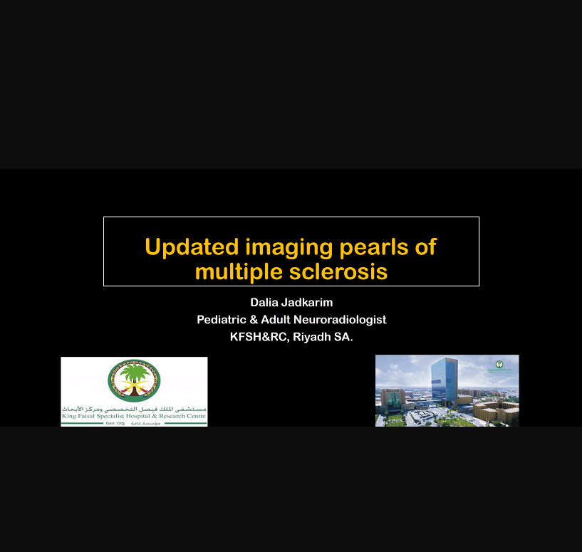 Saudi RAD Society (@rssafeed) on Twitter photo Happening Now!!! #RSSA Live Webinar
📢Multiple Sclerosis Pearls and Differential Diagnoses with Dr. Dalia Jadkareem
Join us now !!
<a href="/DaliaAjk/">DaliaAJK</a>
<a href="/NKhoumais/">Nuha Khoumais, MD, MBA IHM</a>
<a href="/ArwaBadeeb/">Arwa Badeeb</a> Happening Now!!! #RSSA Live Webinar
📢Multiple Sclerosis Pearls and Differential Diagnoses with Dr. Dalia Jadkareem
Join us now !!
<a href="/DaliaAjk/">DaliaAJK</a>
<a href="/NKhoumais/">Nuha Khoumais, MD, MBA IHM</a>
<a href="/ArwaBadeeb/">Arwa Badeeb</a>