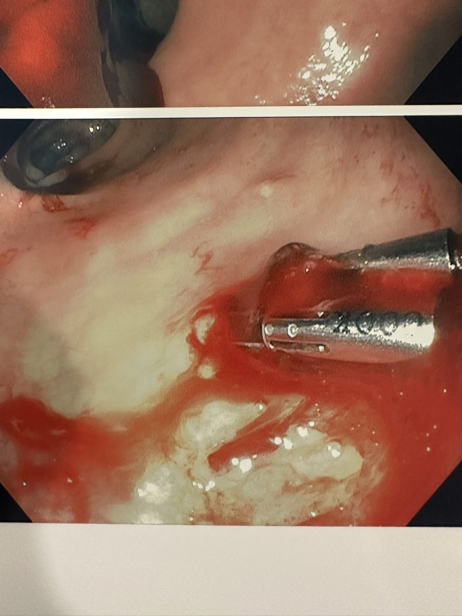 Wassem (Wass) Juakiem #wassupscoping tweet media