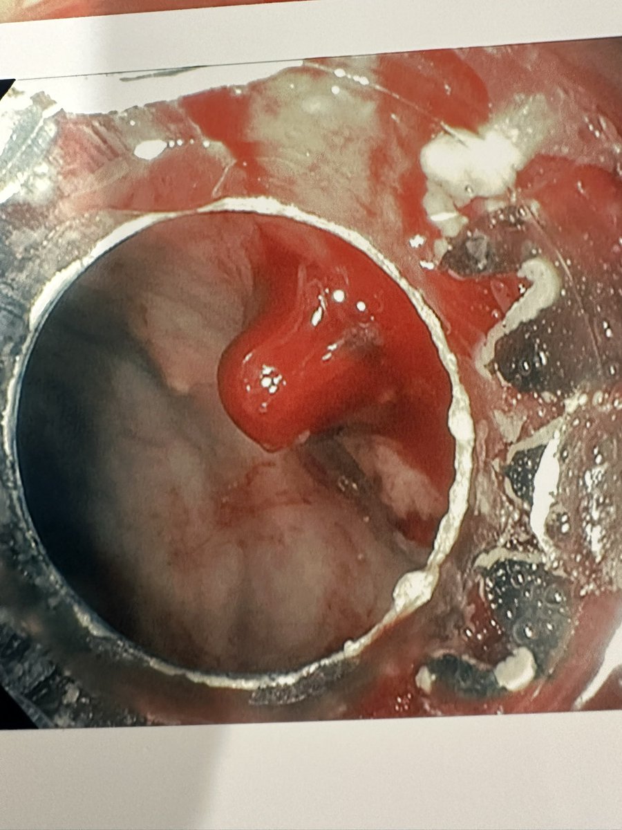 Wassem (Wass) Juakiem #wassupscoping tweet media