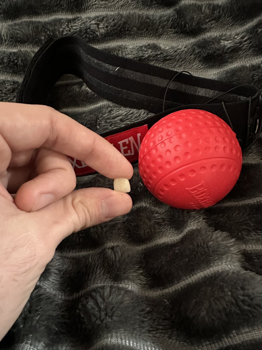 zakfenner's tweet image. Day one of training camp is going great. @boxbollen you owe me a new front tooth. I can’t even get this fixed until Monday. 😡