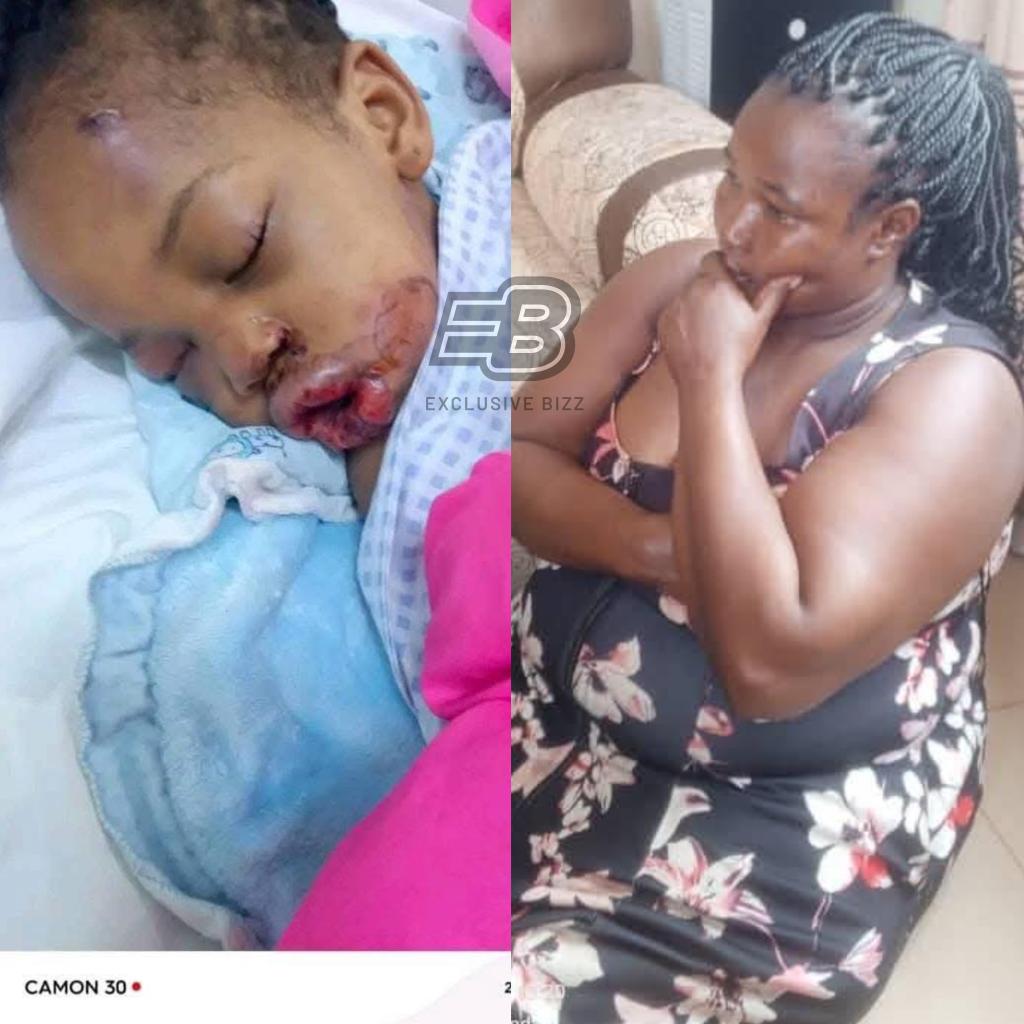 exclusive_bizz's tweet photo. Baby's current state, after allegedly being tortured by the housemaid. https://t.co/z5eFZAkwdN