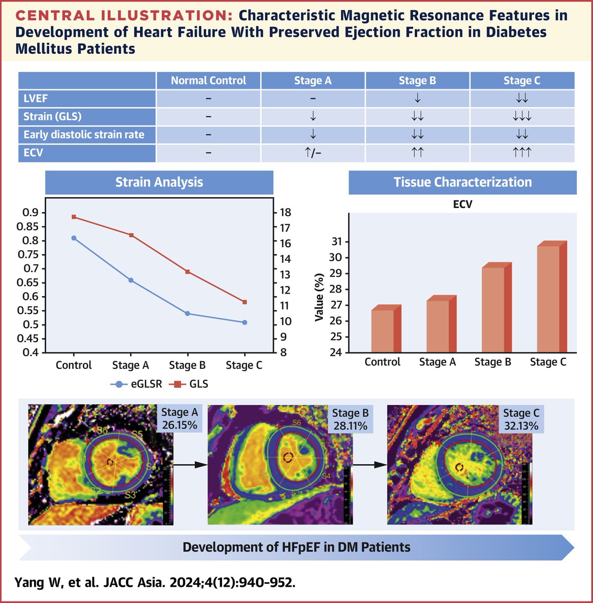 🤔Is it possible to identify pre-HF?

#WhyCMR study reveals subclinical dysfunction &amp; myocardial fibrosis were progressively ⬆️ with advancing #HeartFailure stage jacc.org/doi/10.1016/j.…

#JACCAsia #Diabetes