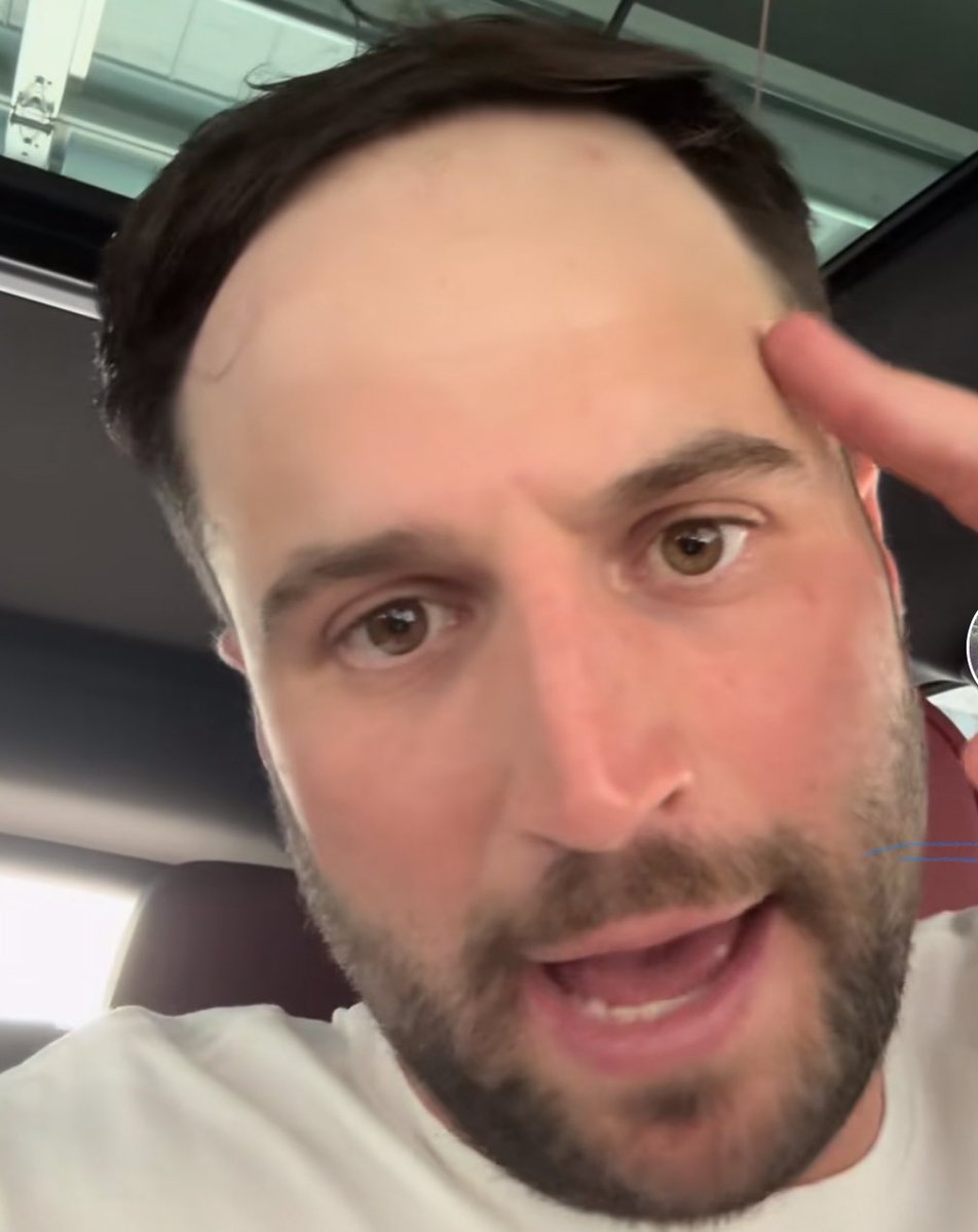 LTF_Forehead tweet picture