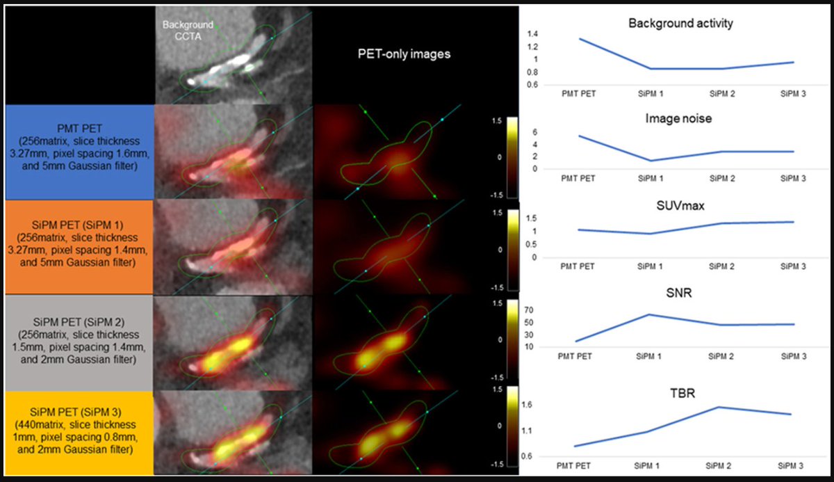 Journal of Nuclear Cardiology (@jncjournal) on Twitter photo In 18F-NaF coronary PET imaging, silicone photomultipliers with digital photon counting PET showed superior imaging contrast and less image noise compared with photomultiplier tubes PET. <a href="/Piotr_JSlomka/">Piotr Slomka PhD</a> <a href="/CedarsSinai/">Cedars-Sinai</a>
Read now👉bit.ly/4gxa26Z
#cvnuc In 18F-NaF coronary PET imaging, silicone photomultipliers with digital photon counting PET showed superior imaging contrast and less image noise compared with photomultiplier tubes PET. <a href="/Piotr_JSlomka/">Piotr Slomka PhD</a> <a href="/CedarsSinai/">Cedars-Sinai</a>
Read now👉bit.ly/4gxa26Z
#cvnuc