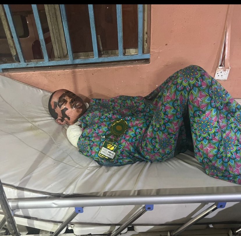 Good day all. I hope we still remember <a href="/Uptownoflagos/">UptownOfLagos</a> . I am dead serious that one burns patient is capital intensive and emotionally demanding. This our brother is handling 3 family members in this our “Tinubu Economy “ . Obidient reach out to him in anyway this Xmas season