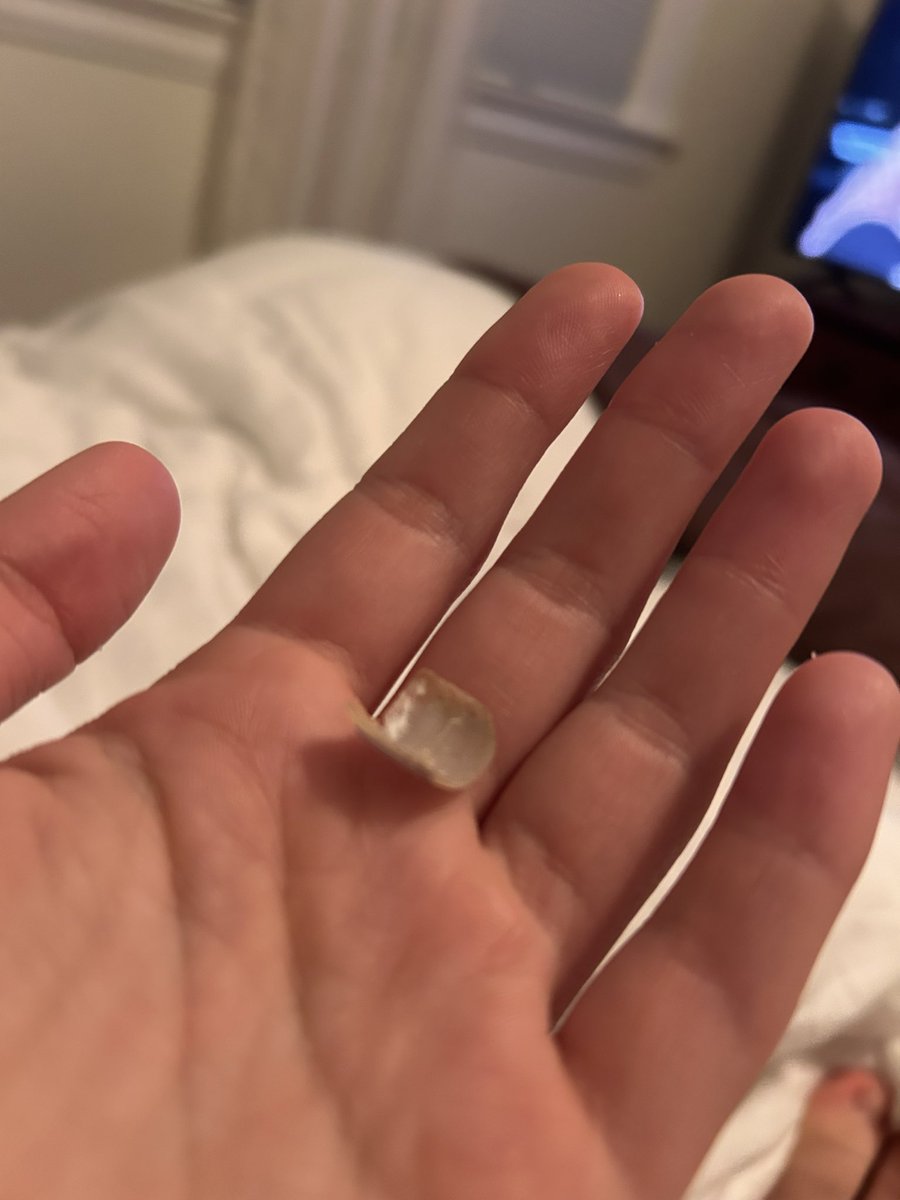 AmateurPurtytoe's tweet photo. My toenail broke off finally

$50 send to see 
$500 and I’ll mail it to you lmaoooo

#findom #feetworshi̇p #feetfindom #gooners #suckers #feetlovers https://t.co/zxqv3EFiTn