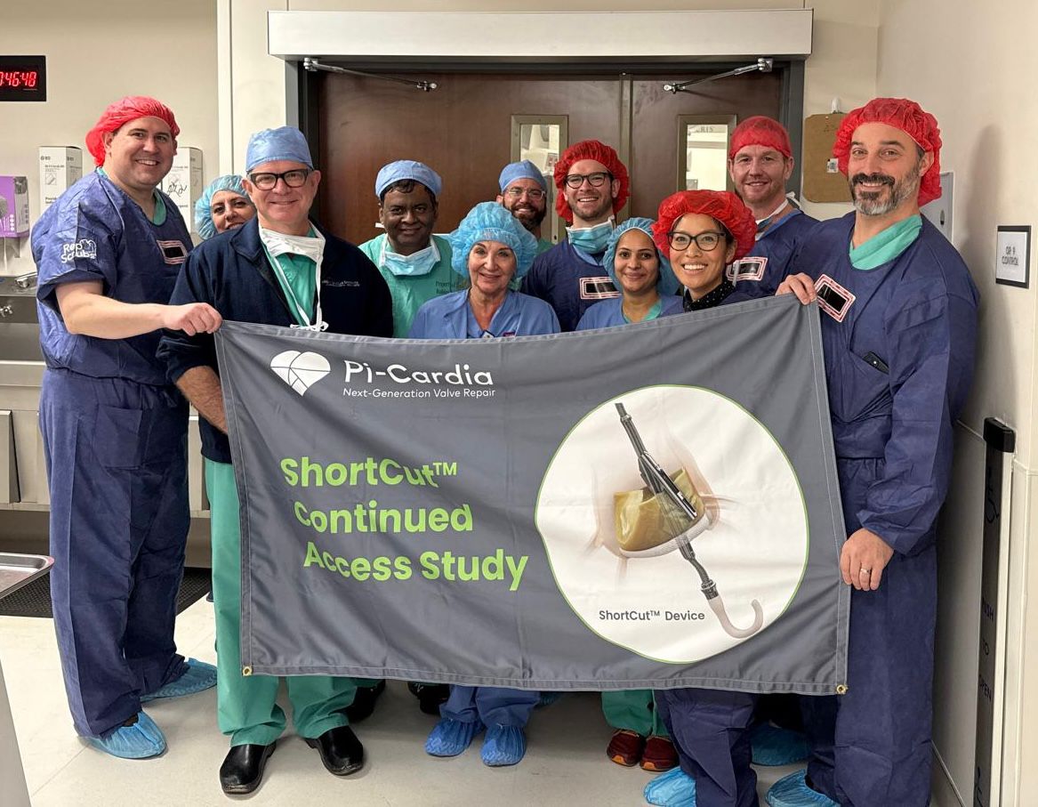 Pi-Cardia (@pi_cardia) on Twitter photo ShortCut Continued Access Study Completes Enrollment! ๐
An outstanding ShortCut case was performed by Dr. <a href="/SaibalKar/">Saibal Kar</a>, Dr. <a href="/Greg/">Greg</a> Fontana, and the #HeartTeam at <a href="/Los_RoblesCA/">Los Robles Regional Medical Center</a>. The team successfully split both the LCC and RCC leaflets in just 20 minutes, enabling a safe TAVR with ShortCut Continued Access Study Completes Enrollment! ๐
An outstanding ShortCut case was performed by Dr. <a href="/SaibalKar/">Saibal Kar</a>, Dr. <a href="/Greg/">Greg</a> Fontana, and the #HeartTeam at <a href="/Los_RoblesCA/">Los Robles Regional Medical Center</a>. The team successfully split both the LCC and RCC leaflets in just 20 minutes, enabling a safe TAVR with