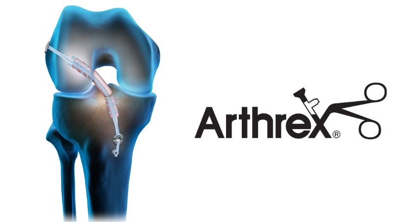 ODTmagazine's tweet image. .@ArthrexMedEd releases new data on #InternalBrace for ACL tears in young athletes: hubs.li/Q02_Xj2h0

#ACLrepair #ACLtear