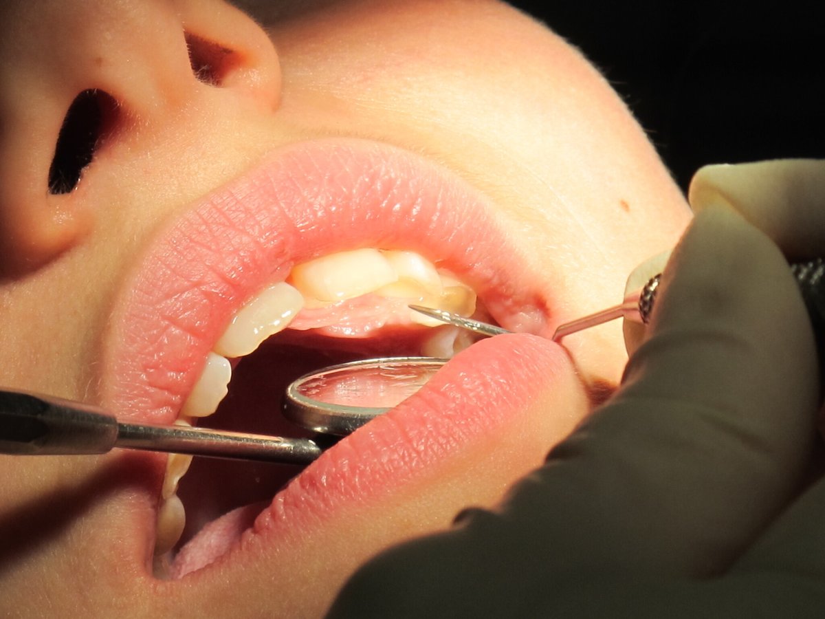 le_Parisien's tweet photo. Des chercheurs japonais travaillent sur un médicament pour faire repousser les dents
➡️ https://t.co/M6NJMSWVTx https://t.co/qpT08ZM3jk