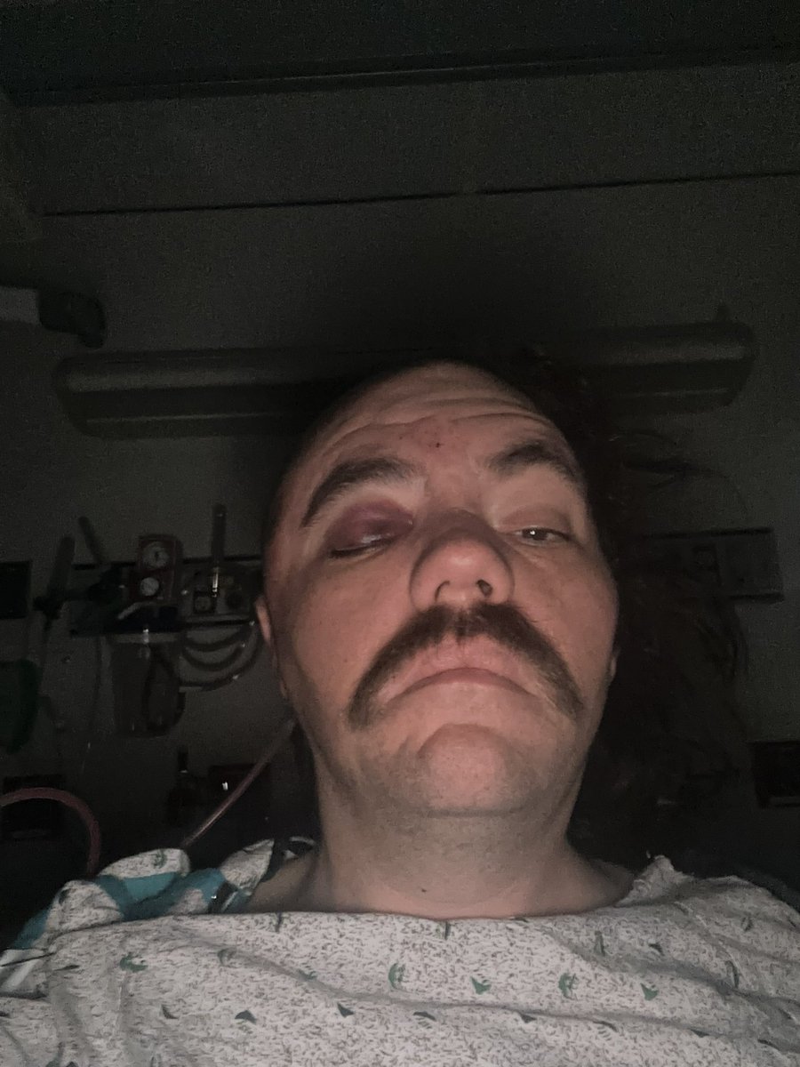 GRIMGRIMGRIM tweet media