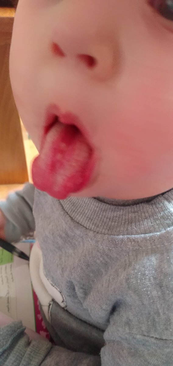helpmyfamily00's tweet photo. ‼️URGENT

My baby Revan is suffering from a bacterial infection, severe stomach pain and chronic diarrhea due to polluted water, air and unhealthy food.Please help her get the support she needs by donating, sharing and doing evrything u can to save her!!

https://t.co/5hDSBkBSYe https://t.co/ikmJib3ObW