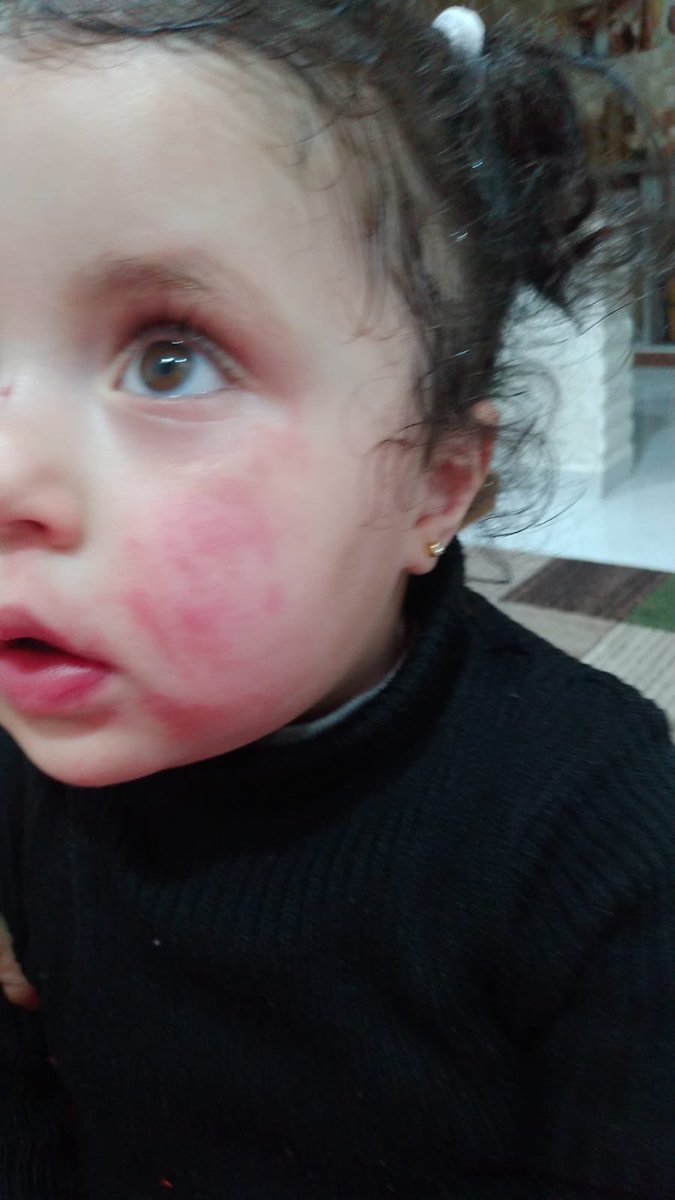 helpmyfamily00's tweet photo. ‼️URGENT

My baby Revan is suffering from a bacterial infection, severe stomach pain and chronic diarrhea due to polluted water, air and unhealthy food.Please help her get the support she needs by donating, sharing and doing evrything u can to save her!!

https://t.co/5hDSBkBSYe https://t.co/ikmJib3ObW