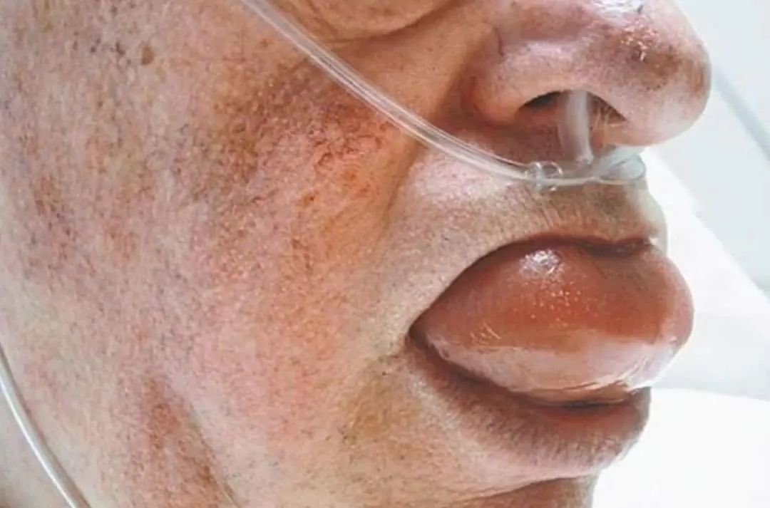 Dr Honey choudhary 🩺 tweet media