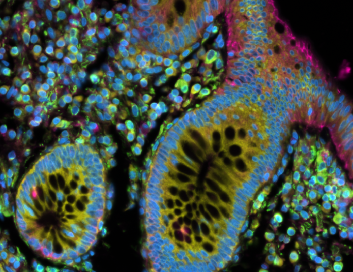 TheGregoryLab's tweet photo. This week's @10xGenomics #Xenium run out of the #DukeMGC on #colon & #lung tissue.
#SingleCells, single cells, single all the way! 🧬📷
#SpatialTranscriptomics #InSituSequencing #10xGenomics #scRNAseq #CoreFacility https://t.co/gOLf1oF8ei