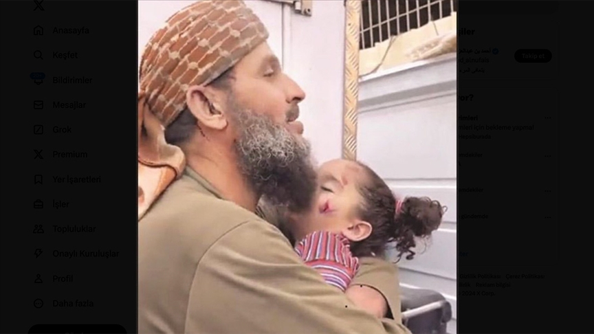 Rim, 3 yaşında bir melekti.Dedesi Halid,ruhumun ruhu diyerek, meleğini cennete uğurlamıştı.Bugün Halid de, Lanetli Kavmin Siyonistlerince şehid edildi.. Bu, yüzbinlerce masum hikayeden biri. Lanetli siyonistler, sadece sonlarını hızlandırıyorlar.Bizdeki iman ve azim onlara yeter