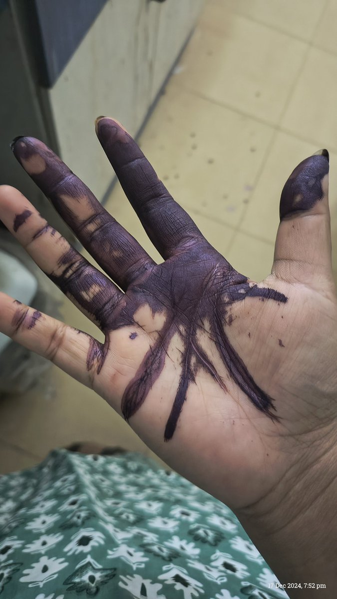 Priyanka2110118's tweet photo. Jis haat se compound banayi
Usko hi rang Diya usi se hi
🤡
#accidentalmark
By the way face and ankh mein girti toh ab tak puri 600 acres ki campus ko pata chal jati..🫠 https://t.co/GbmjG5WdVN