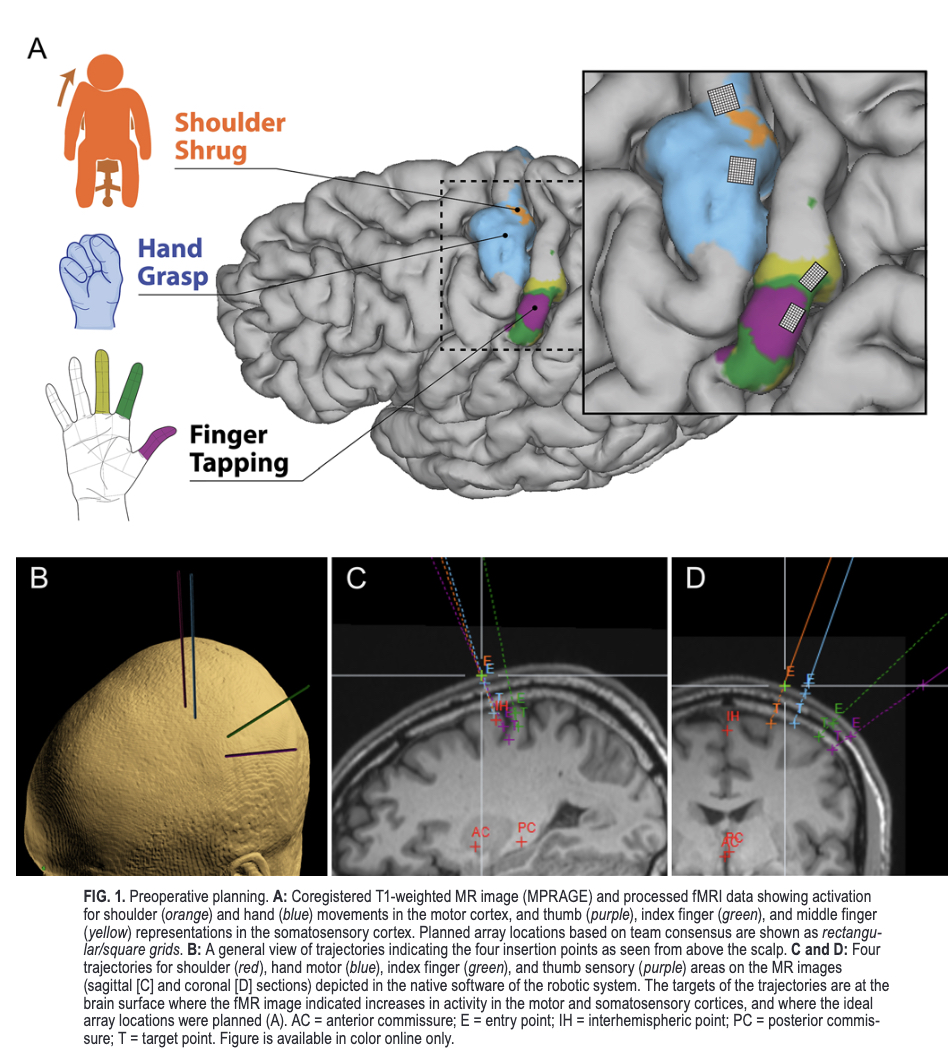 Journal of Neurosurgery tweet media