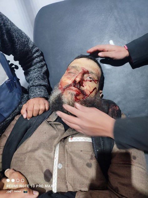 <a href="/Israel/">Israel ישראל</a> <a href="/mikispitzer/">Miki Spitzer מיקי שפיצר</a> Ethnic cleanse

📸 Israeli terrorists