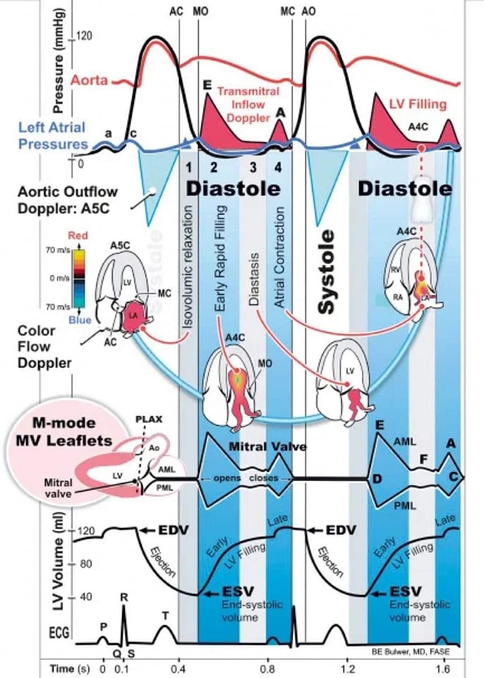 🔴Excellent illustration depicting the relationship between cardiac cycle, Doppler parameters and M-mode at the mitral valve level.  

Courtesy🔗thoracickey.com/m-mode-imaging/
#cardiology #CardioEd #meded #POCUS