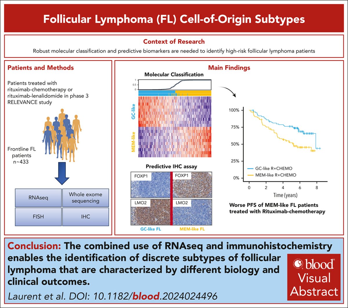 IHC can be used routinely to identify patients with MEM-like FL with adverse PFS who can benefit from treatments other than R-chemotherapy. ow.ly/PkpS50UqaeL #lymphoidneoplasia #clinicaltrialsandobservations