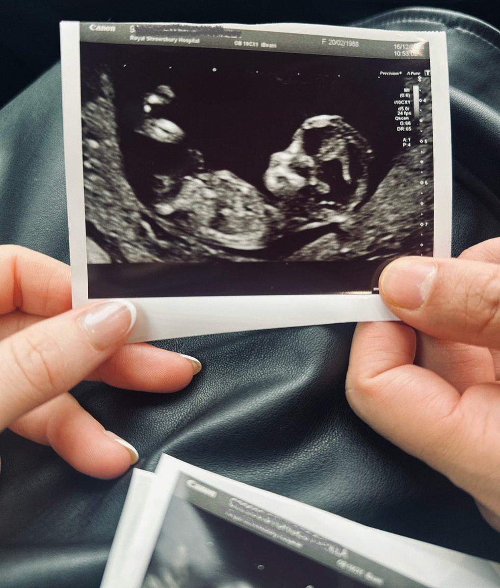 Entering our mom and dad era 
June 2025
#babynews