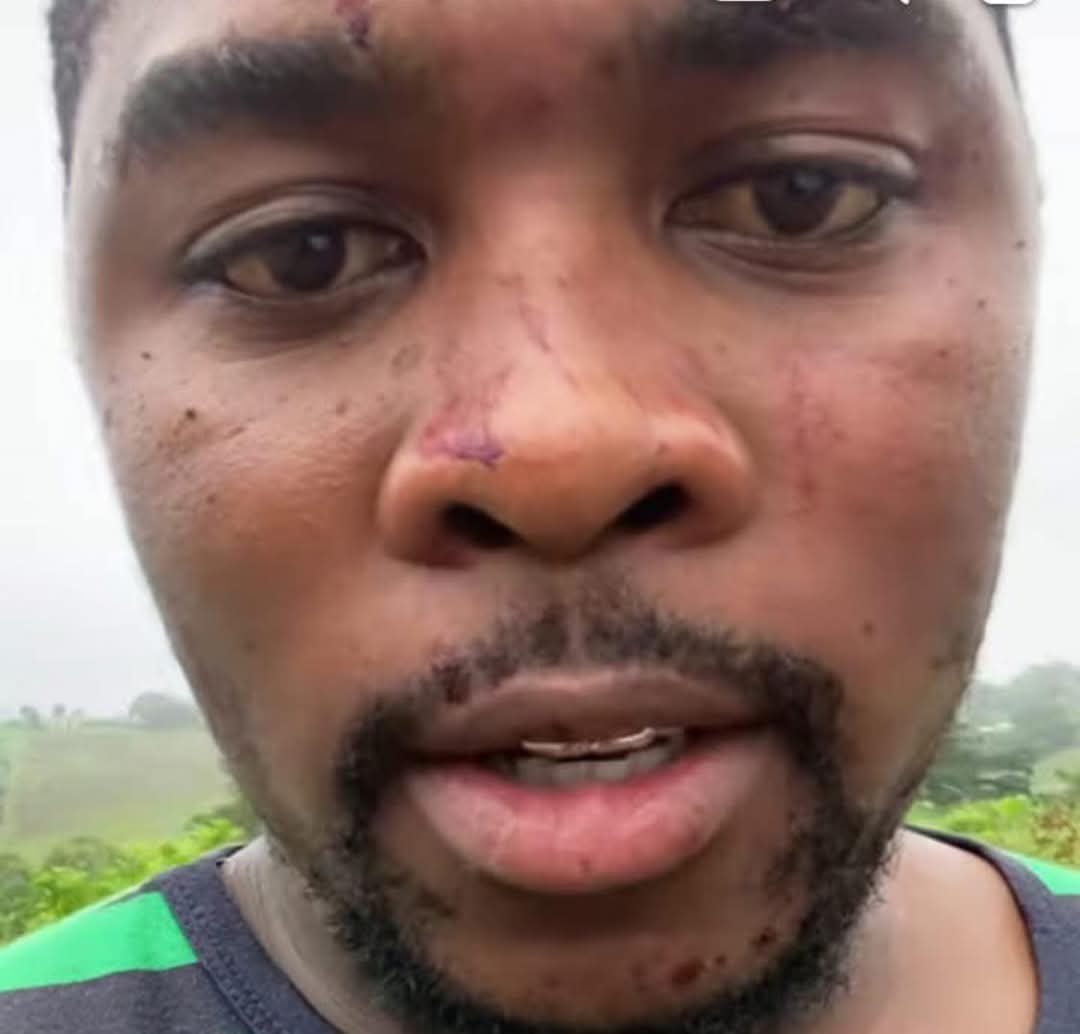 tumi_tulipz's tweet photo. I hope the community gets to Sbusiso Lawrence before the police do https://t.co/R8kYwtQ5TI