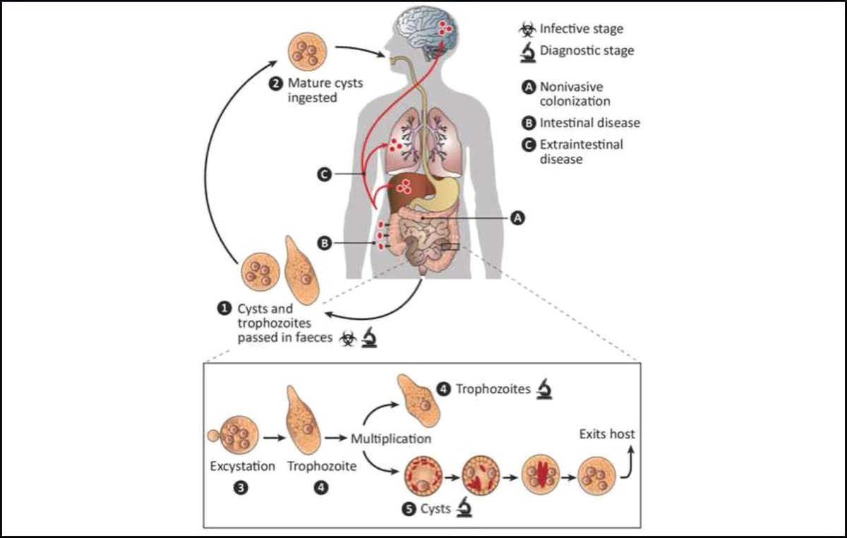 FrontGastro_BMJ's tweet photo. #FGImage from the article "Recent advances in the diagnosis and management of amoebiasis" in the January 2025 Issue of FG
https://t.co/1Ejwtf2TC3 https://t.co/eYPVe6Ak8g