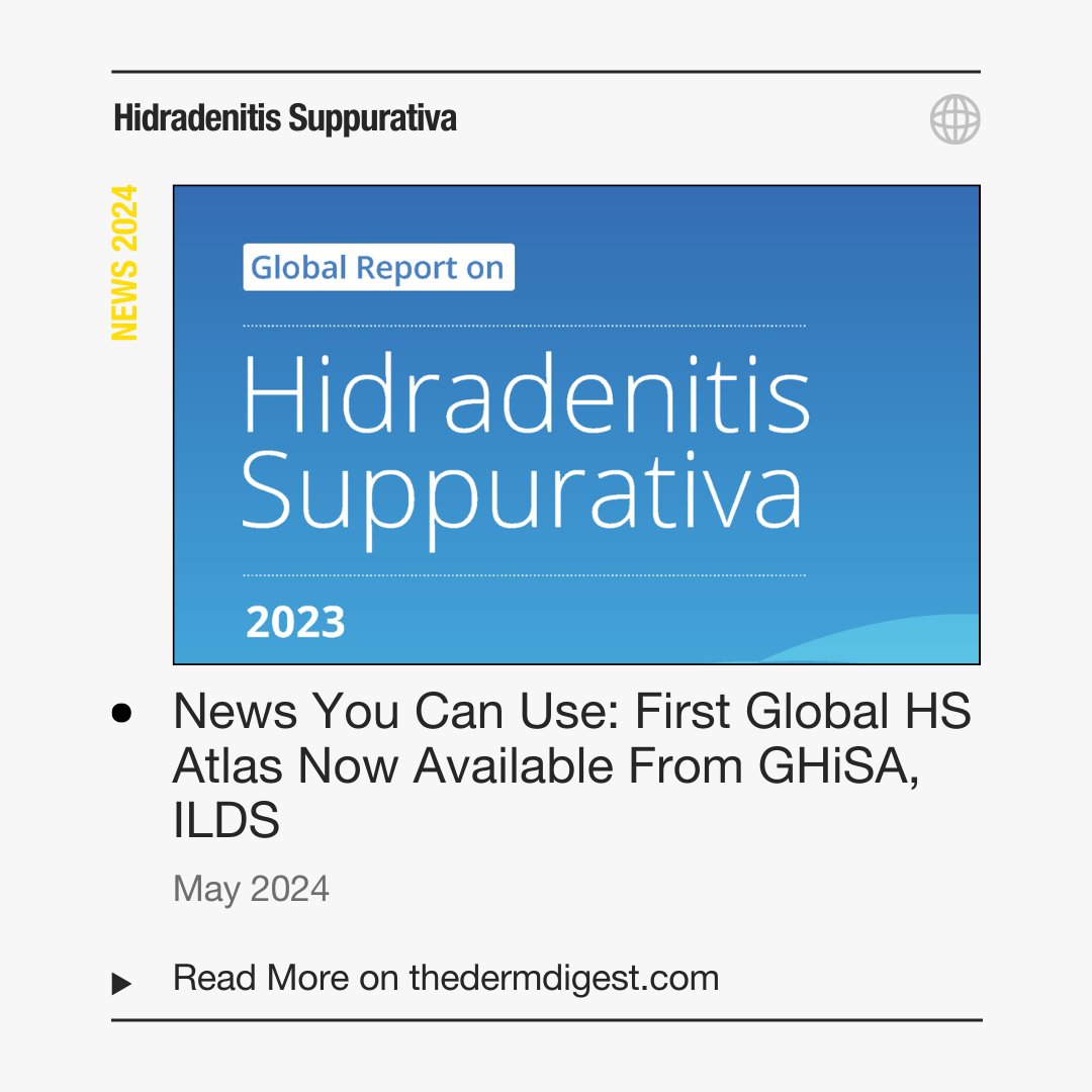Review this year's top #HidradenitisSuppurativa headlines and breaking news with The Derm Digest. See the complete archive of HS articles: thedermdigest.com/hidradenitis-s…