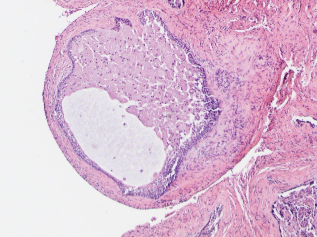 Tim Bracey tweet media